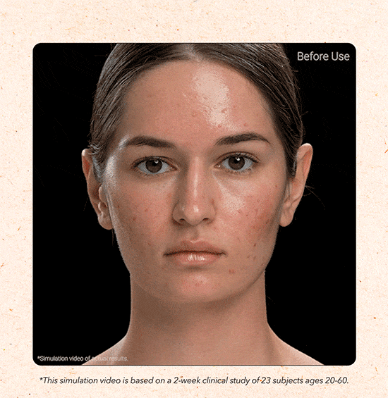 APRILSKIN MY Carrotene Pimple Stopper