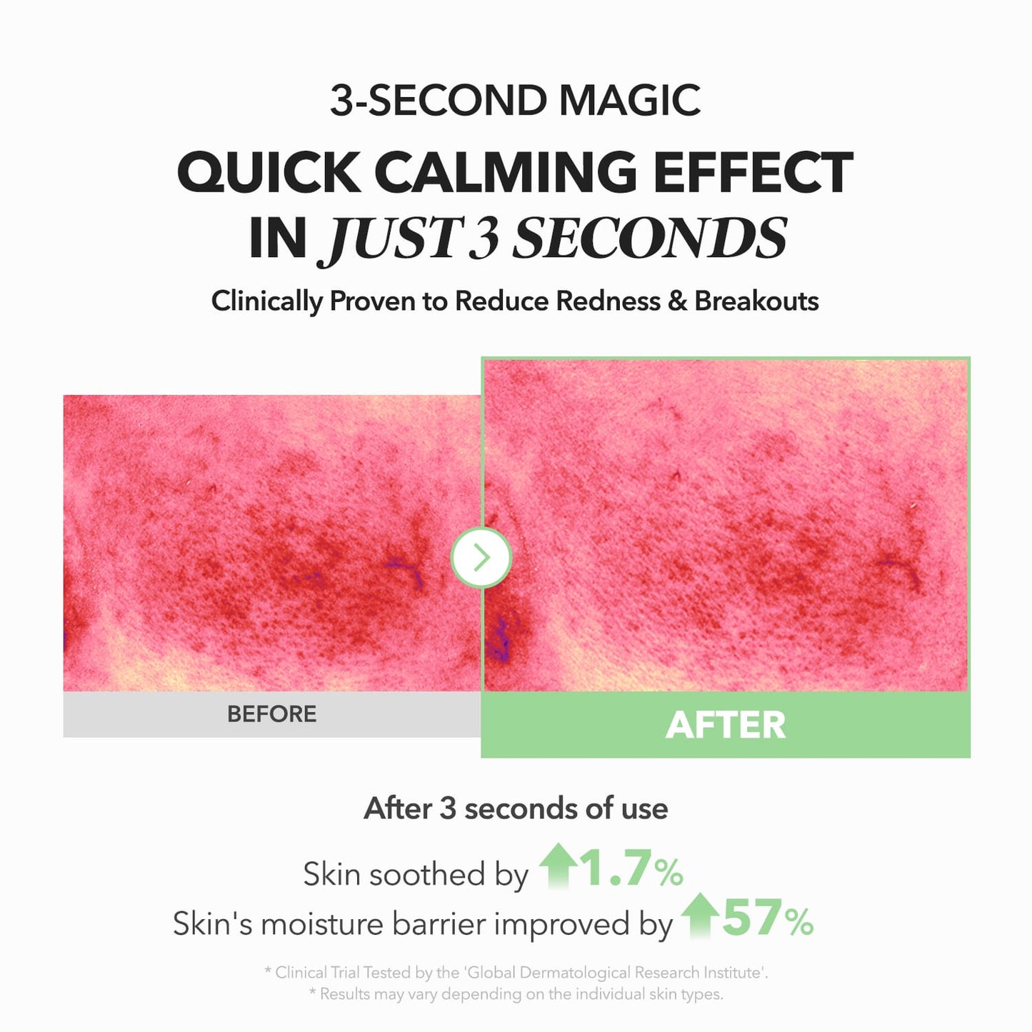 APRILSKIN MY A.C.E Mugwort Centella Calming Serum
