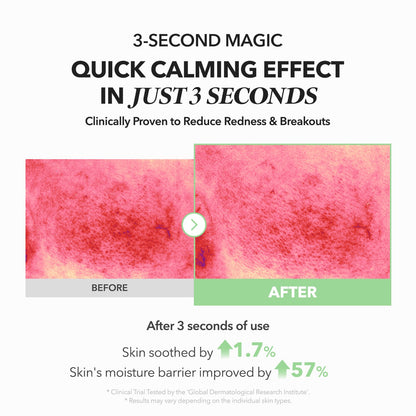 APRILSKIN MY A.C.E Mugwort Centella Calming Serum