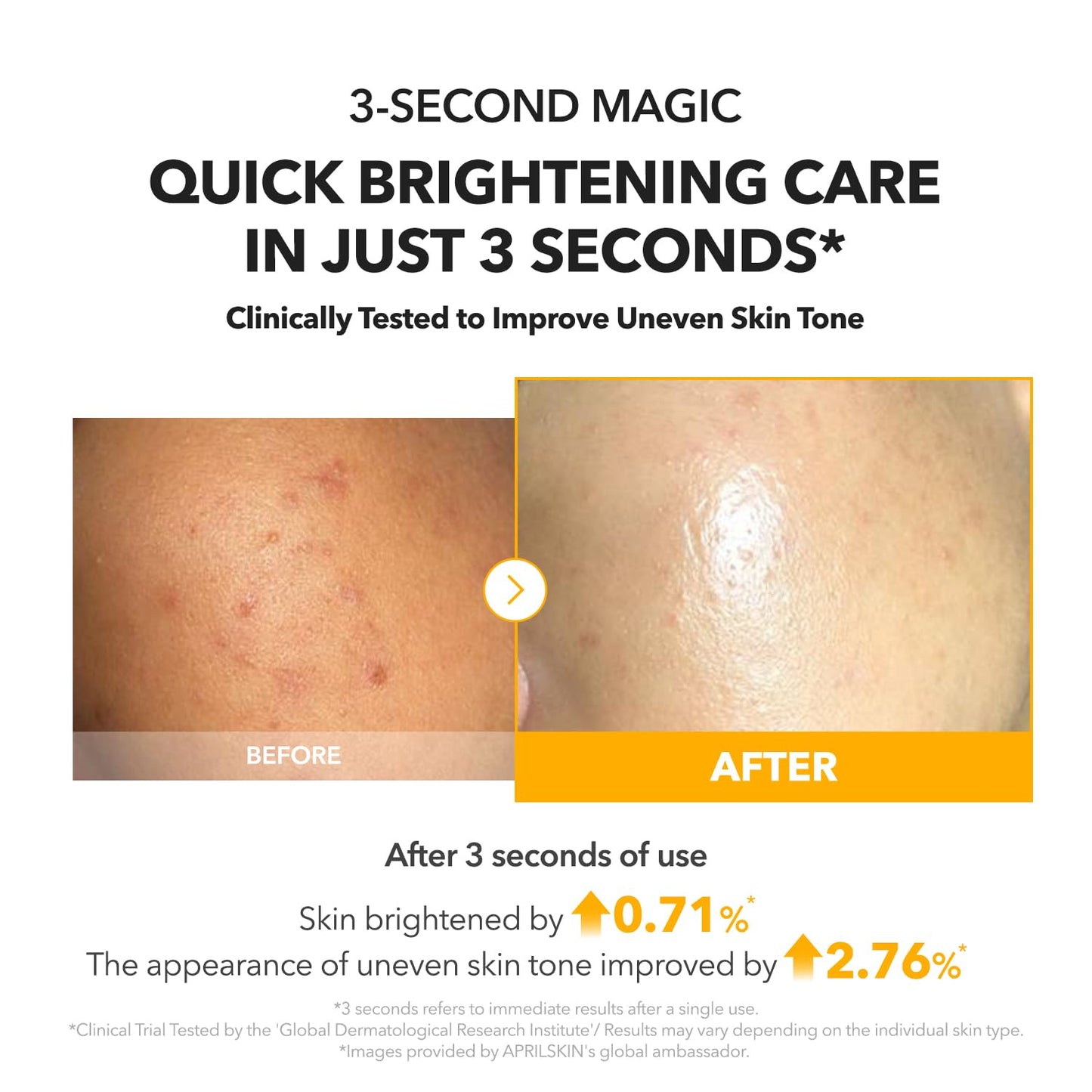 APRILSKIN MY A.C.E Vita Kojic Brightening Serum