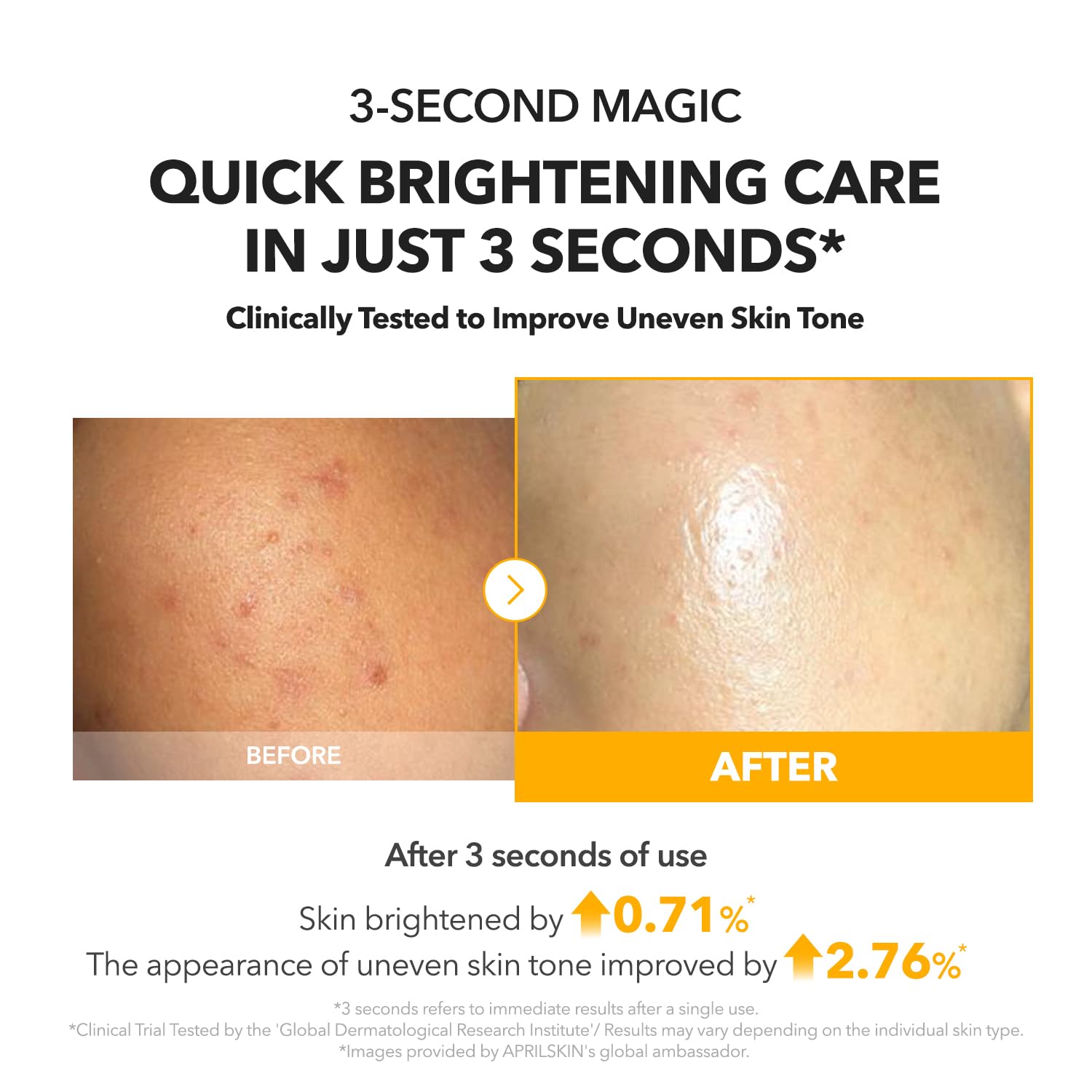 APRILSKIN MY A.C.E Vita Kojic Brightening Serum