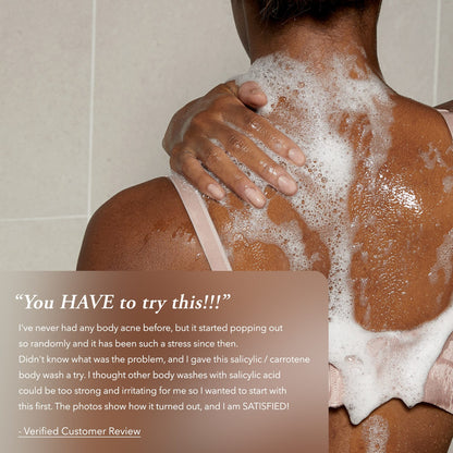 Aprilskin skincare Carrotene IPMP™ Exfoliating Body Wash