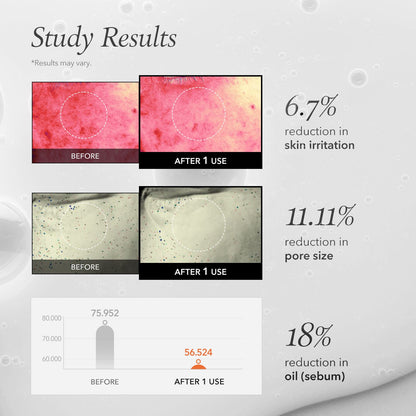 Aprilskin skincare Carrotene IPMP™ Instant Calming Serum Pads