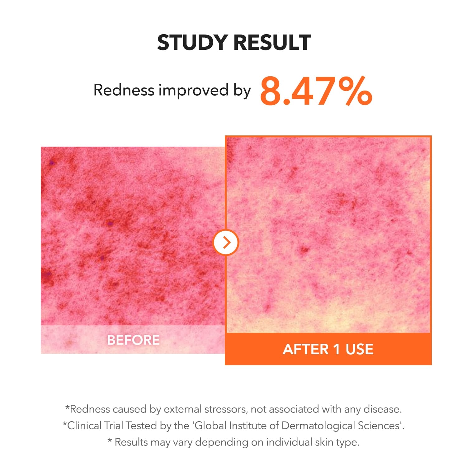 APRILSKIN skincare Carrotene Pimple Stopper
