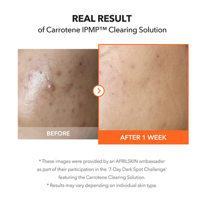 APRILSKIN skincare Carrotene Pimple Stopper