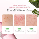 Aprilskin skincare [NEW] Pink Aloe Brightening Mucin Serum