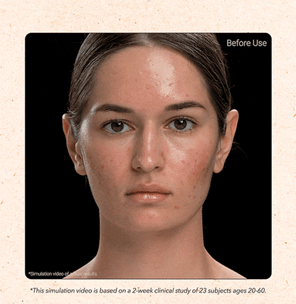 APRILSKIN MY Carrotene Pimple Stopper